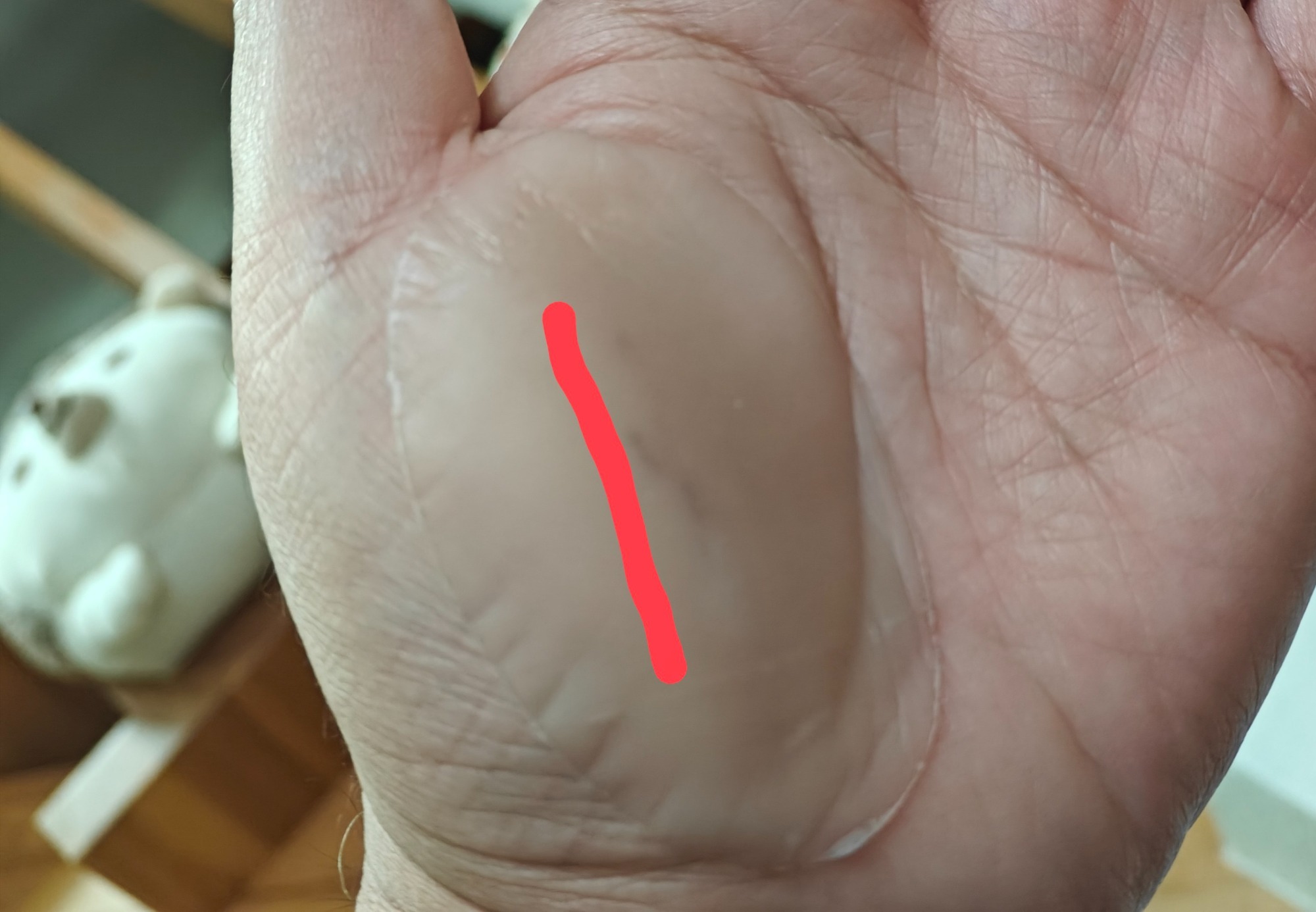 手をざっくり切ってしまいの画像